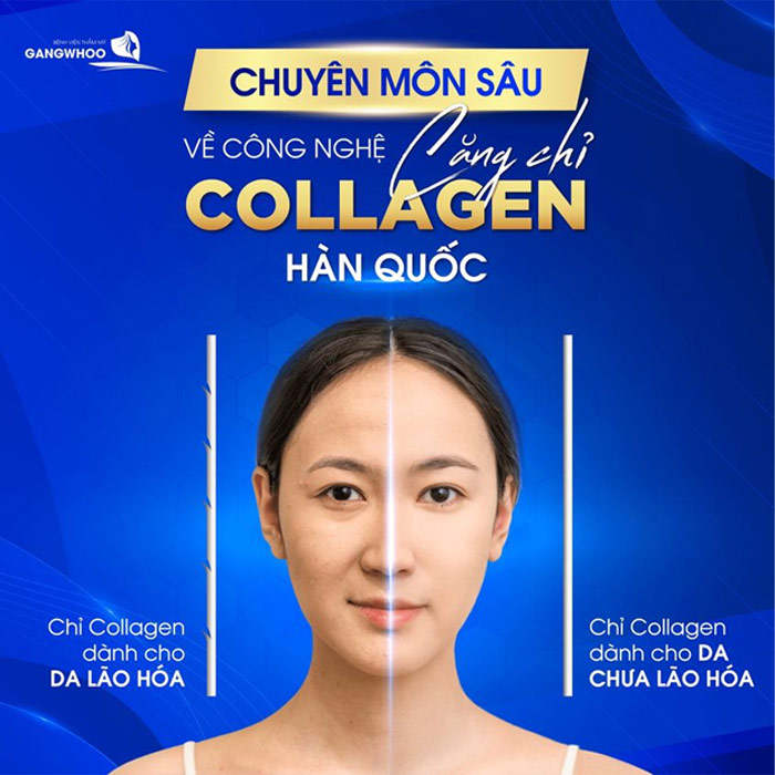 Cấy chỉ collagen căng da mặt uy tín và thẩm mỹ tại Gangwhoo